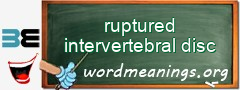 WordMeaning blackboard for ruptured intervertebral disc